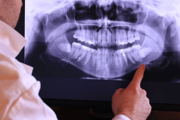 Best Emergency Wisdom Teeth Removal in Enterprise, UT